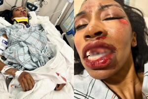 La actriz de Marvel, Carrie Bernans, sufrió múltiples lesiones, fracturas y rupturas de dientes tras ser atropellada.