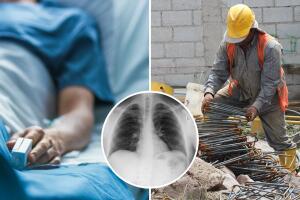 Conoce la alarmante situación de la silicosis en la industria de la construcción y cómo los trabajadores latinos están sufriendo las devastadoras consecuencias de esta enfermedad pulmonar debido a la exposición a la sílice.