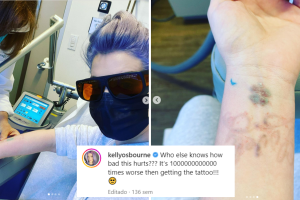 Kelly Osbourne borró sus tatuajes