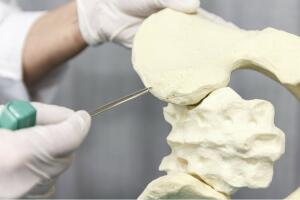 Que-es-la-osteopetrosis-2.jpg