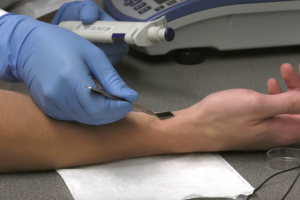 Nanochip regenerador