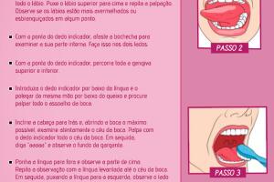 autoexame-boca-cancer.jpg
