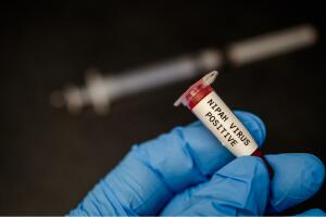 virus-del-nipah-vni-brote-oms-1099121678.jpg