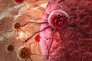 cancer-celula-doenca-0519-1400x800.jpg