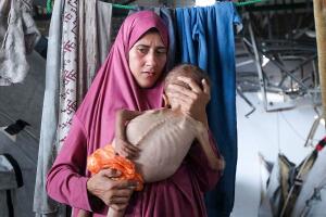 Malnourished-baby-highlights-Gaza-crisis