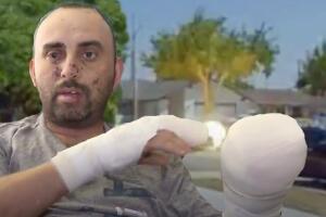 jardinero-hispano-hector-mayoral-pierde-vision-dedos-y-dientes-al-recoger-bolita-que-exploto-en-los-angeles