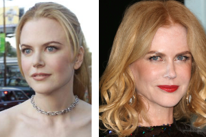 nicolekidman-getty.png
