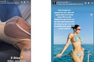 Yailin La Más Viral se redujo los implantes mamarios