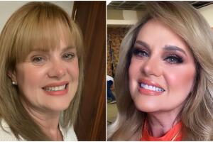 Erika Buenfil asegura que no abusa del bótox para verse joven