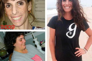 jovem-foi-de-25-a-100-kg-antes-depois.jpg