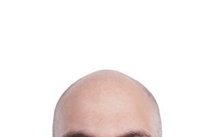Completely bald man head