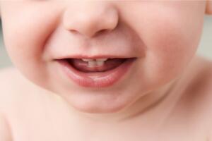 dente-bebe-0217-1400x800.jpg