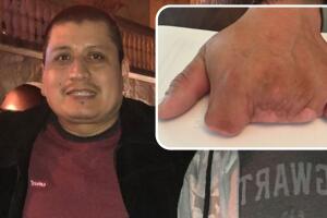 La Barbecue restaurante Aaron Gomez hispano pierde dedos mano accidente laboral Austin Texas