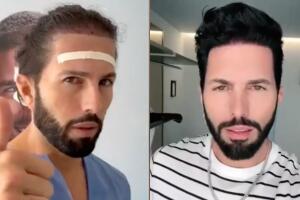 Poncho de Nigris se realizó un injerto de cabello a finales de 2022.