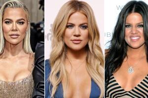 Khloé Kardashian agradece por su “nariz perfecta” a 3 años de haberse operado: así era antes