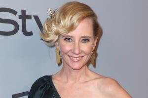 Anne Heche: lesiones por quemaduras y fractura en el esternón, las causas oficiales de su muerte