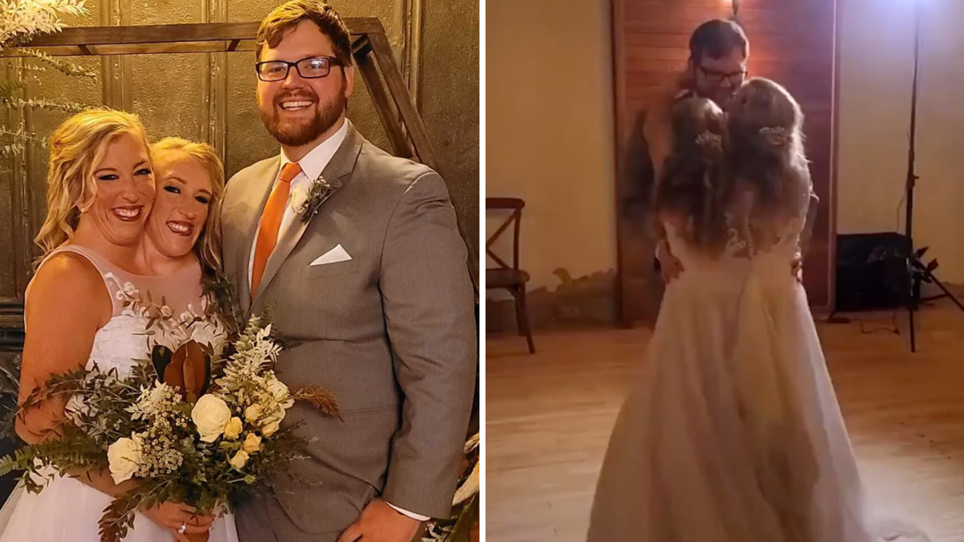 Siamesas Abby y Brittany Hensel: ¿Qué pasó con ellas? ¿Cuántos años tienen?  ¿Cómo viven? Su historia tras la boda de una de las gemelas |  Entretenimiento Cultura Pop | Univision, image size:1920x1080