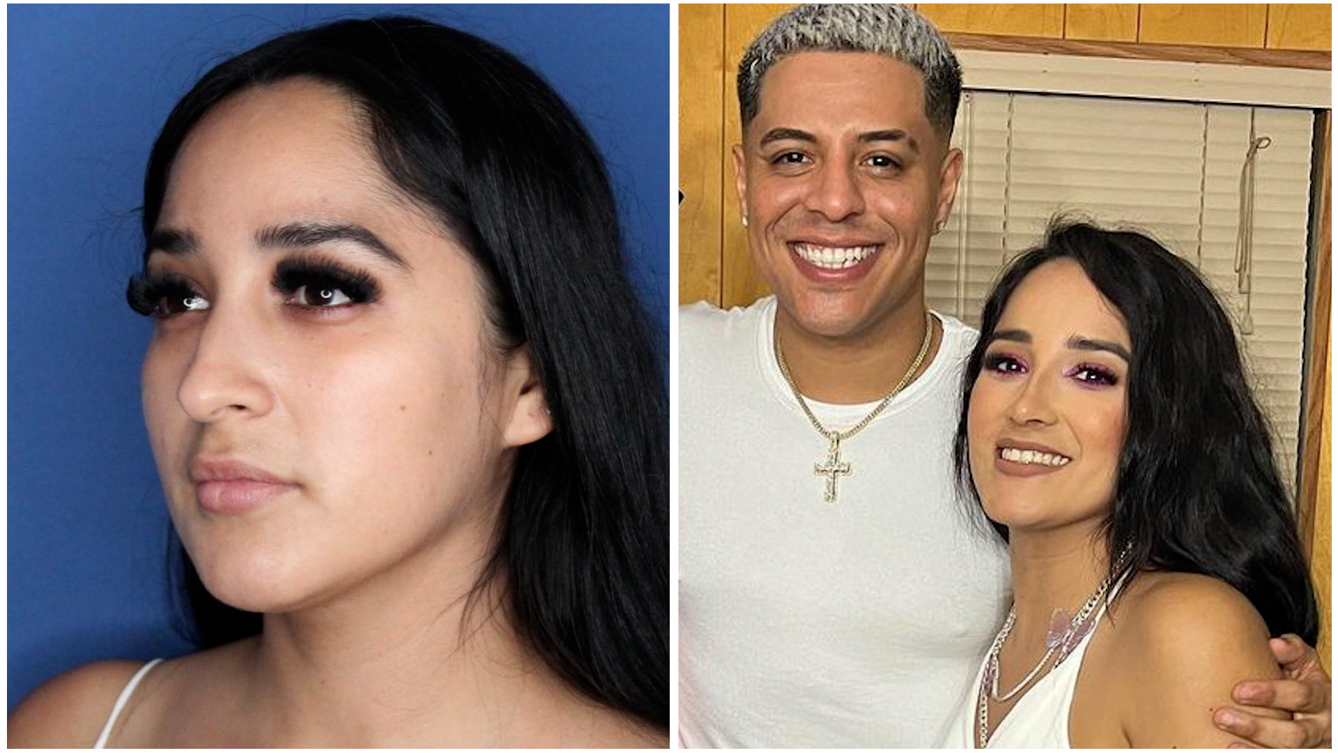 "La papada se fue" Daisy Anahy muestra el antes y después tras sus